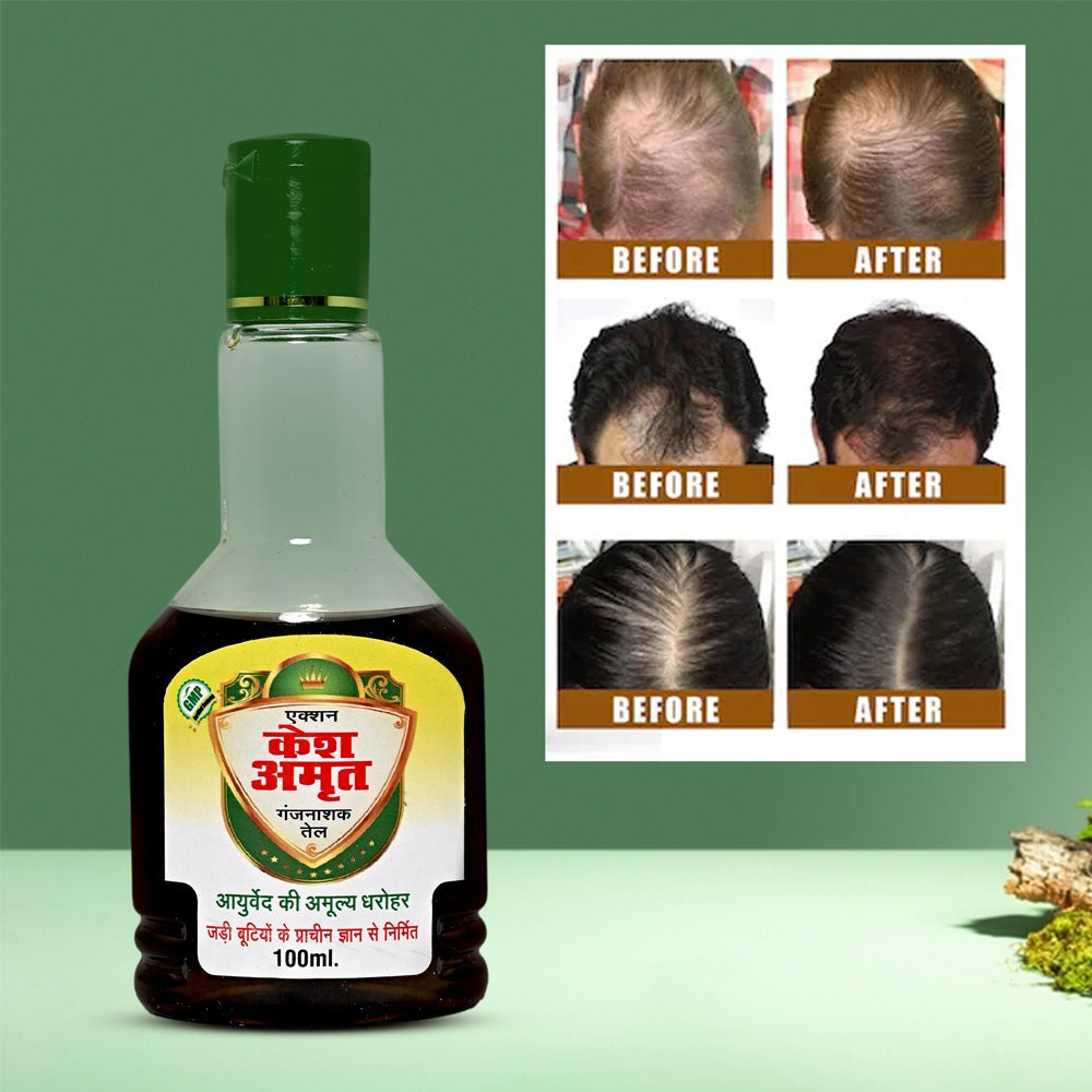 Action Pharma Kesh Amrit Ganjnashk Oil - 100ml